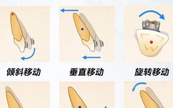 加速牙齿正畸移动的方法