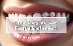 种植牙究竟能维持多少年？