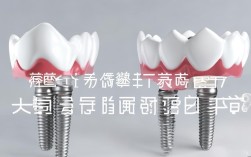 诺贝尔种植牙和ITI系统，哪个更适合你？