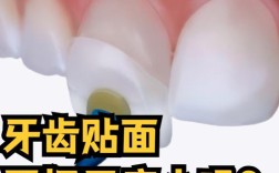 牙齿磨小有方法吗？具体如何操作？