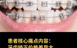 池州成人牙齿矫正