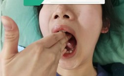 正畸治疗会影响颞下颌关节健康吗？