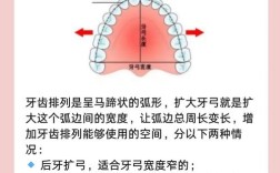 正畸是如何实现牙齿内收的？