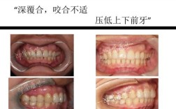 矫正牙齿可以做手术吗？非手术矫正可行吗？
