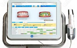 固定正畸复诊期间需监控哪些关键内容？