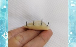 正畸平面导板厚度