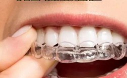 7天快速矫正牙齿？真的能快速见效且不伤牙吗？