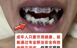 成年人牙齿可以矫正吗？矫正效果会受年龄影响吗？
