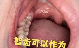 口腔正畸真的能把歪长的智齿掰正吗？原理、效果及适用条件大揭秘