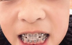 泉州整牙齿矫正去哪里好？靠谱医院医生如何挑选？