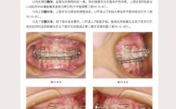 武广增正畸实用