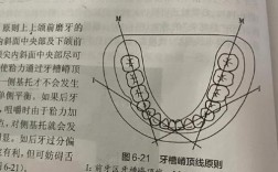 前牙排牙的具体方法
