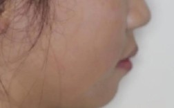 牙齿矫正后，牙齿会松动吗？