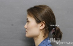 颧骨宽大的人群正畸真的能改善面型吗？会不会因颧骨条件限制效果？医生如何制定个性化方案？