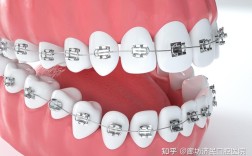 廊坊牙齿矫正哪里最好？求推荐靠谱好医院！