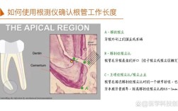 第六代vdw根测仪的详细使用方法与操作步骤是什么？
