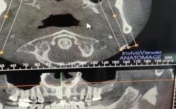 正畸用北医分析具体指什么？有何独特优势？