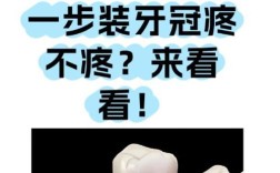 种牙后牙冠怎么戴？详细步骤有哪些？
