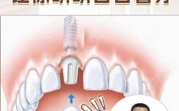大门牙镶牙和种牙，哪种更适合修复？
