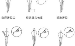 牙胶尖充填方法的关键步骤有哪些？