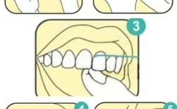 正畸时牙线怎么用？正确使用方法是什么？