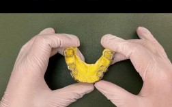 正畸推磨牙前移8mm可行吗？效果与风险如何？