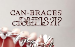 2025牙套矫正效果如何？专家最新解析来了！