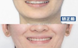 北京牙齿矫正去哪里好？靠谱机构怎么选？