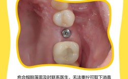 种牙愈合帽是什么？种植牙过程必备吗？