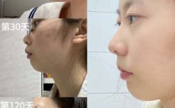 口腔正畸的现状