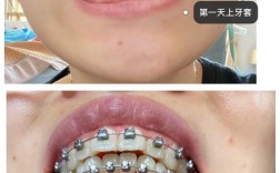 矫正牙齿交流群