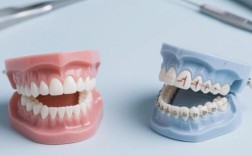 正畸里面频道是啥