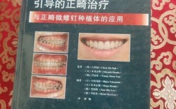 正畸相关牙周治疗