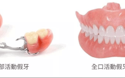 活动义齿摘戴的正确方法有哪些步骤和技巧？