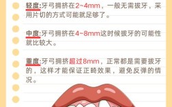 牙齿矫正一般拔几号牙