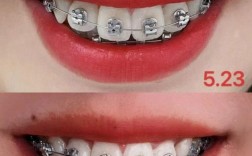 杭州市二口腔正畸