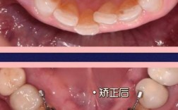 长春有舌侧正畸吗