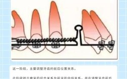 关闭牙间隙的常用方法有哪些？
