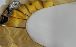 南京矫正牙齿和镶牙，哪个更适合你的牙齿问题？