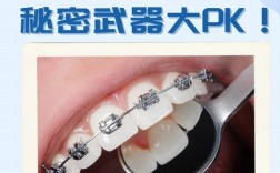 西湖巴尔正畸牙托效果如何？