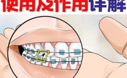 正畸治疗中常用的粘固材料种类有哪些？