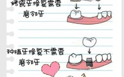 种牙怎么看牙好坏？材料、医生、技术是关键！