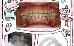 牙齿保持器能用来矫正牙齿吗？