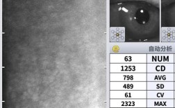 隐形正畸病例报告，疗效与美观如何兼顾？