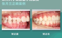 郑州矫正牙齿哪里好
