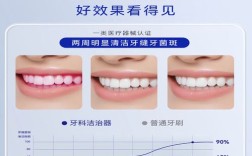 成人正畸牙齿清洁，如何做到有效清洁？