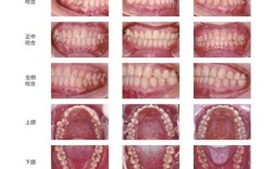 牙齿反合矫正有哪些常用有效的方法？