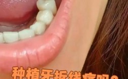种牙后拆线时间、疼痛及护理注意事项有哪些？