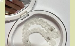 时代天使隐形正畸活动有哪些惊喜福利？