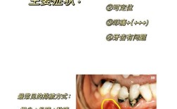 根尖周炎的表示方法具体包含哪些临床特征与影像学表现，如何综合判断其存在与严重程度？